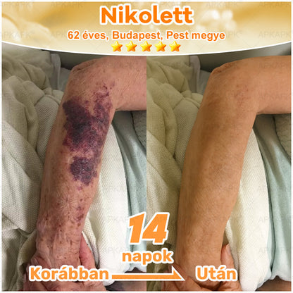 🏆𝖠𝖯𝖪𝖠𝖯𝖪® 🌿Méhméreges bőrregeneráló krém Segít kezelni különféle bőrproblémákat, mint például: ráncok, hegek, pigmentfoltok, striák, pattanások, pikkelysömör, ekcéma, bőrkárosodások, irritációk, gyulladások és egyéb bőrproblémák💦