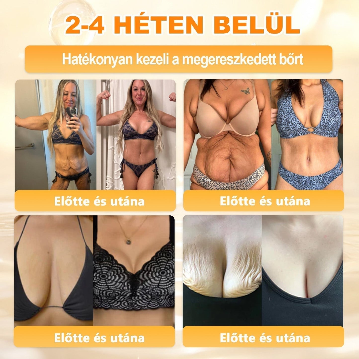 🏆𝖠𝖯𝖪𝖠𝖯𝖪® 🌿Méhméreges bőrregeneráló krém Segít kezelni különféle bőrproblémákat, mint például: ráncok, hegek, pigmentfoltok, striák, pattanások, pikkelysömör, ekcéma, bőrkárosodások, irritációk, gyulladások és egyéb bőrproblémák💦