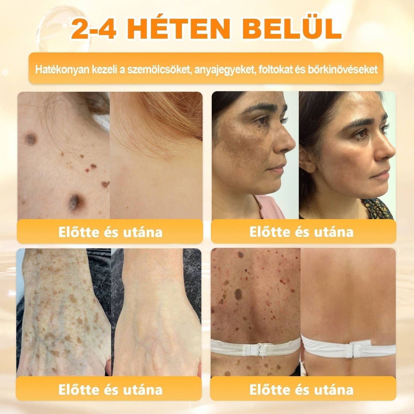 🏆𝖠𝖯𝖪𝖠𝖯𝖪® 🌿Méhméreges bőrregeneráló krém Segít kezelni különféle bőrproblémákat, mint például: ráncok, hegek, pigmentfoltok, striák, pattanások, pikkelysömör, ekcéma, bőrkárosodások, irritációk, gyulladások és egyéb bőrproblémák💦
