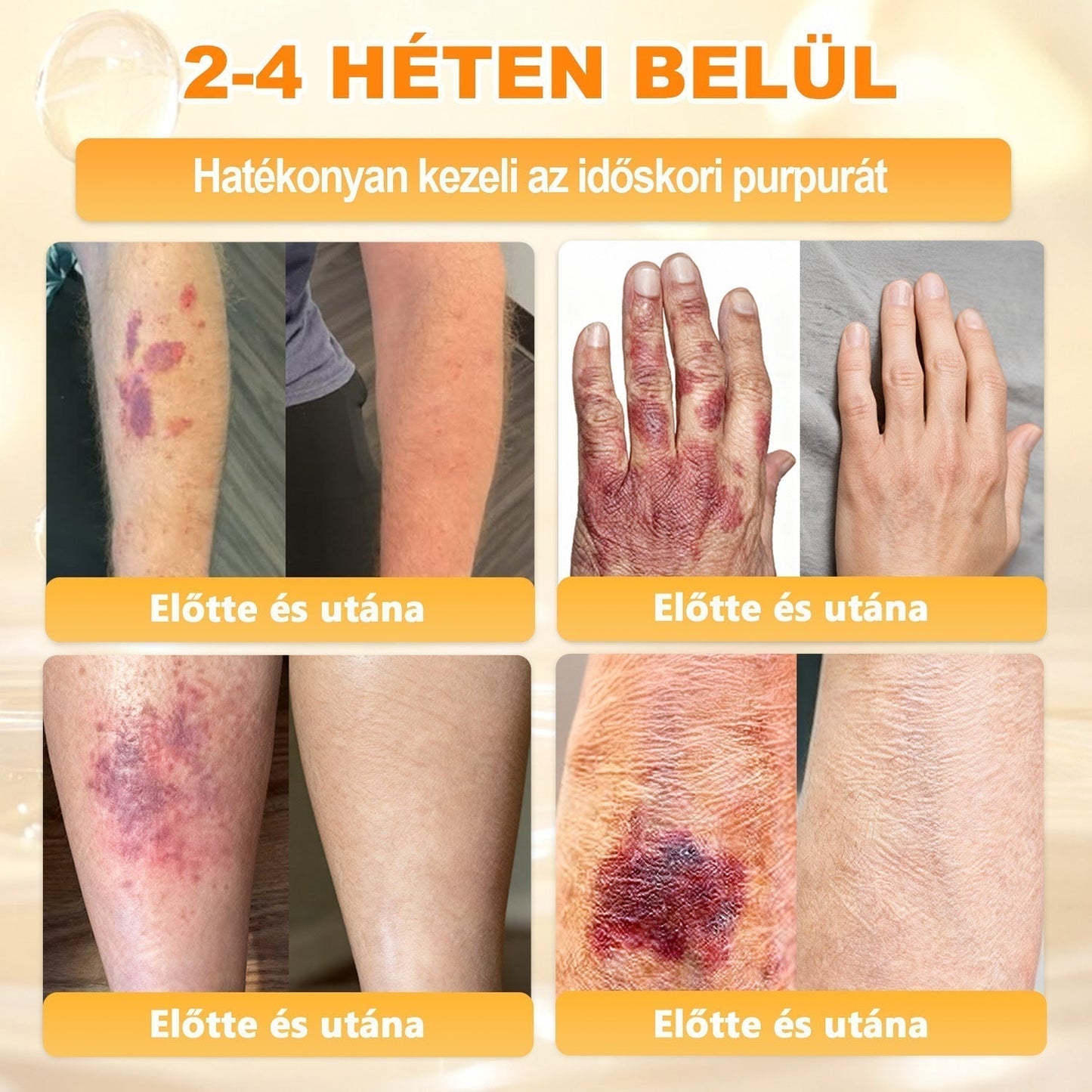 🏆𝖠𝖯𝖪𝖠𝖯𝖪® 🌿Méhméreges bőrregeneráló krém Segít kezelni különféle bőrproblémákat, mint például: ráncok, hegek, pigmentfoltok, striák, pattanások, pikkelysömör, ekcéma, bőrkárosodások, irritációk, gyulladások és egyéb bőrproblémák💦