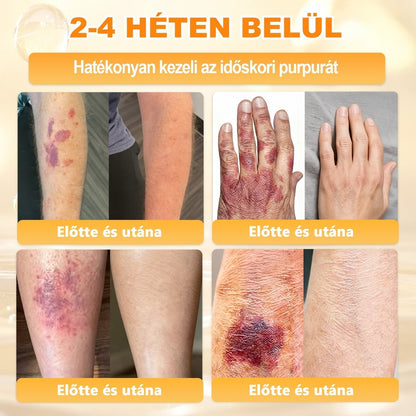 🏆𝖠𝖯𝖪𝖠𝖯𝖪® 🌿Méhméreges bőrregeneráló krém Segít kezelni különféle bőrproblémákat, mint például: ráncok, hegek, pigmentfoltok, striák, pattanások, pikkelysömör, ekcéma, bőrkárosodások, irritációk, gyulladások és egyéb bőrproblémák💦