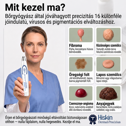 Hivatalos Márkabolt | 🖊️ Hiskin® 7 napos Szemölcseltávolító Roll-on Ápoló Folyadék (Fájdalommentes rollerball technológia, hegek nélkül) 🐬