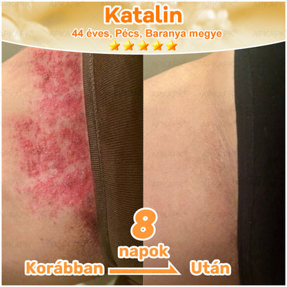 🏆𝖠𝖯𝖪𝖠𝖯𝖪® 🌿Méhméreges bőrregeneráló krém Segít kezelni különféle bőrproblémákat, mint például: ráncok, hegek, pigmentfoltok, striák, pattanások, pikkelysömör, ekcéma, bőrkárosodások, irritációk, gyulladások és egyéb bőrproblémák💦