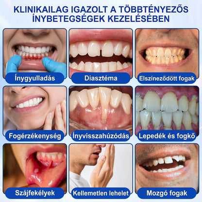 PureShade® 💧 GumRevive Ínyregeneráló Gél – Az egészségesebb ínyért és magabiztosabb mosolyért 🦷