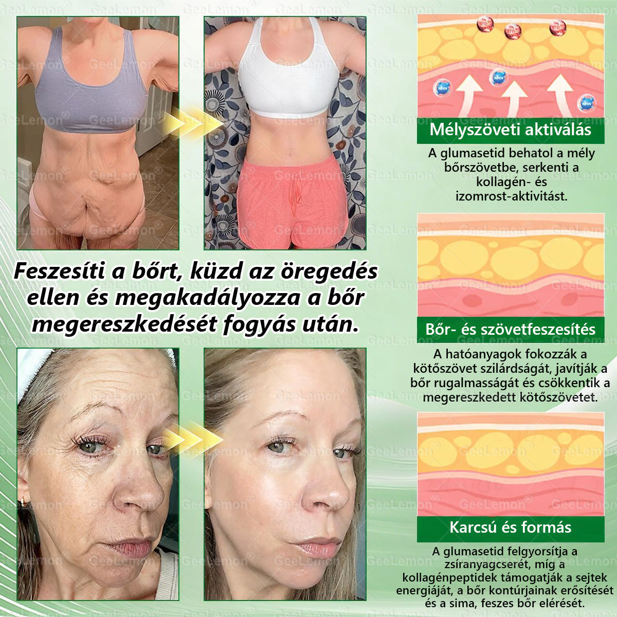 🥇 GeeLemon® 8 az 1-ben karcsúsító nano mikrotűs tapasz 🇭🇺 (Napi egyszeri használat, látható változások már 7 nap alatt) ✅Elhízás,megereszkedett bőr,cukorbetegség,alvási apnoe,ízületi problémák és még sok más esetén