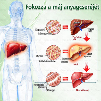 🥇 GeeLemon® 8 az 1-ben karcsúsító nano mikrotűs tapasz 🇭🇺 (Napi egyszeri használat, látható változások már 7 nap alatt) ✅Elhízás,megereszkedett bőr,cukorbetegség,alvási apnoe,ízületi problémák és még sok más esetén