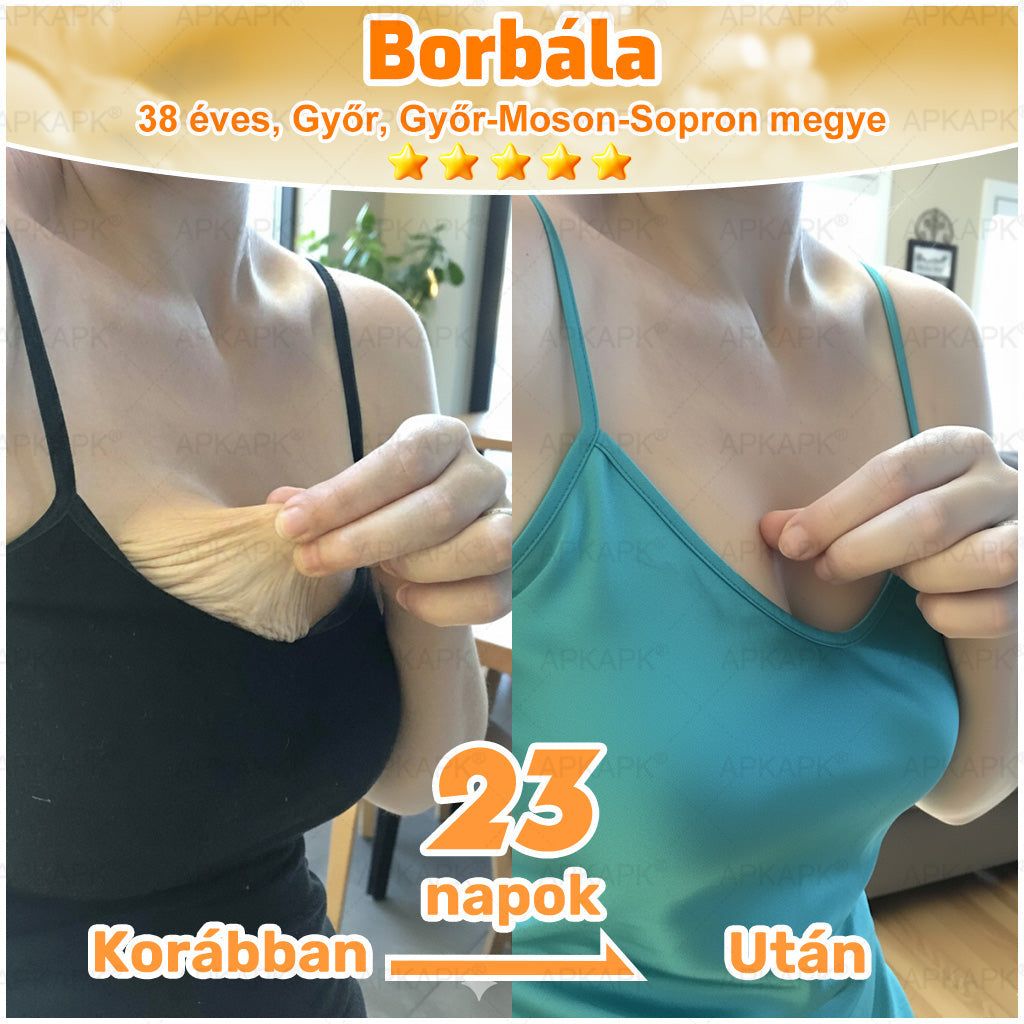 🏆𝖠𝖯𝖪𝖠𝖯𝖪® 🌿Méhméreges bőrregeneráló krém Segít kezelni különféle bőrproblémákat, mint például: ráncok, hegek, pigmentfoltok, striák, pattanások, pikkelysömör, ekcéma, bőrkárosodások, irritációk, gyulladások és egyéb bőrproblémák💦