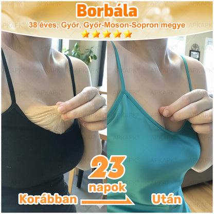 🏆𝖠𝖯𝖪𝖠𝖯𝖪® 🌿Méhméreges bőrregeneráló krém Segít kezelni különféle bőrproblémákat, mint például: ráncok, hegek, pigmentfoltok, striák, pattanások, pikkelysömör, ekcéma, bőrkárosodások, irritációk, gyulladások és egyéb bőrproblémák💦