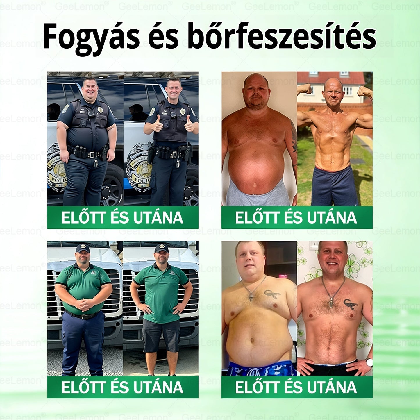 🥇 GeeLemon® 8 az 1-ben karcsúsító nano mikrotűs tapasz 🇭🇺 (Napi egyszeri használat, látható változások már 7 nap alatt) ✅Elhízás,megereszkedett bőr,cukorbetegség,alvási apnoe,ízületi problémák és még sok más esetén
