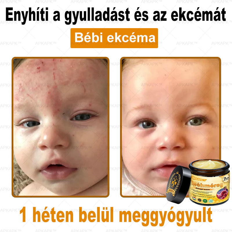 🏆𝖠𝖯𝖪𝖠𝖯𝖪® 🌿Méhméreges bőrregeneráló krém Segít kezelni különféle bőrproblémákat, mint például: ráncok, hegek, pigmentfoltok, striák, pattanások, pikkelysömör, ekcéma, bőrkárosodások, irritációk, gyulladások és egyéb bőrproblémák💦