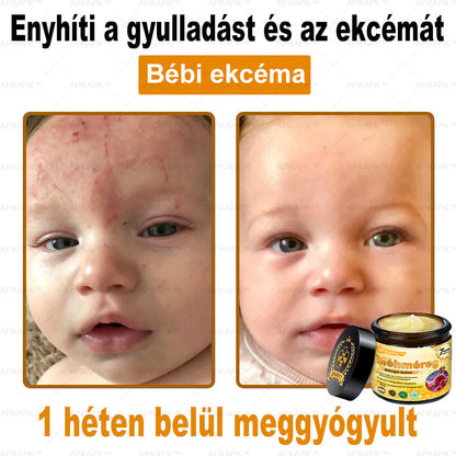 🏆𝖠𝖯𝖪𝖠𝖯𝖪® 🌿Méhméreges bőrregeneráló krém Segít kezelni különféle bőrproblémákat, mint például: ráncok, hegek, pigmentfoltok, striák, pattanások, pikkelysömör, ekcéma, bőrkárosodások, irritációk, gyulladások és egyéb bőrproblémák💦
