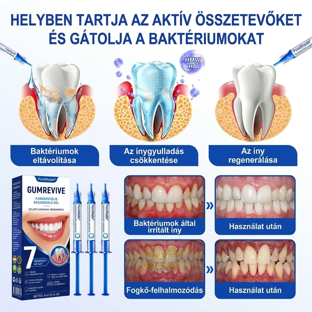 PureShade® 💧 GumRevive Ínyregeneráló Gél – Az egészségesebb ínyért és magabiztosabb mosolyért 🦷