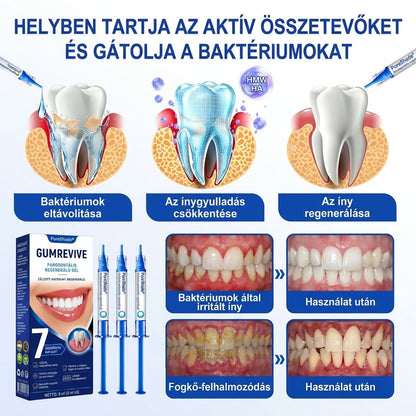 PureShade® 💧 GumRevive Ínyregeneráló Gél – Az egészségesebb ínyért és magabiztosabb mosolyért 🦷