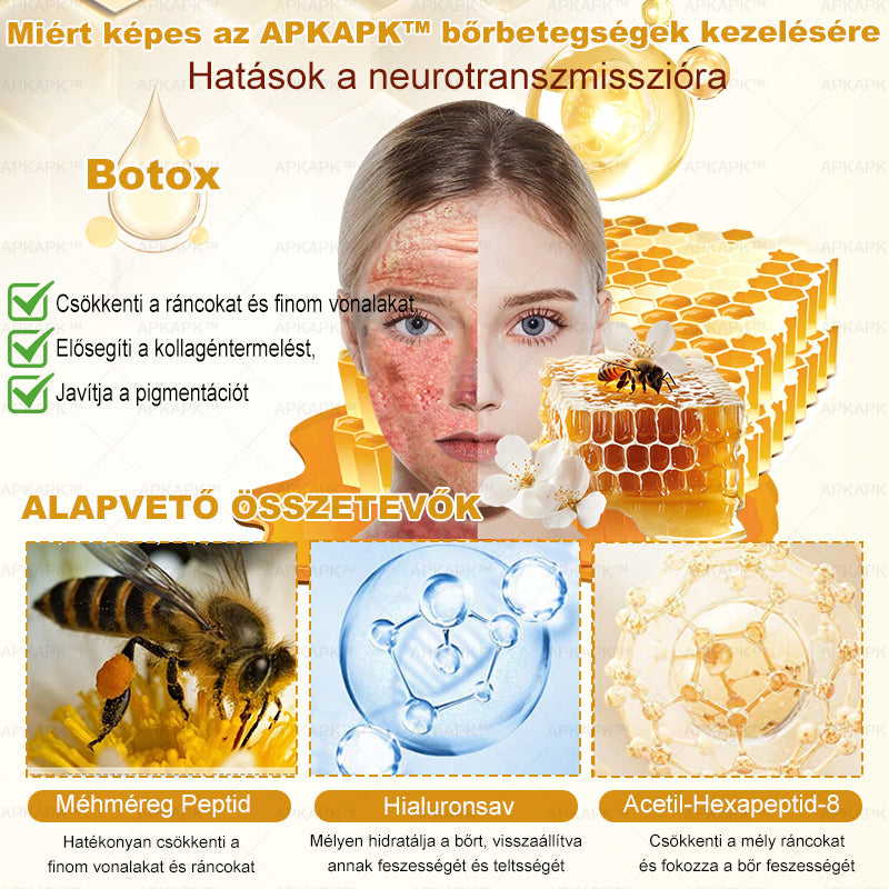 🏆𝖠𝖯𝖪𝖠𝖯𝖪® 🌿Méhméreges bőrregeneráló krém Segít kezelni különféle bőrproblémákat, mint például: ráncok, hegek, pigmentfoltok, striák, pattanások, pikkelysömör, ekcéma, bőrkárosodások, irritációk, gyulladások és egyéb bőrproblémák💦