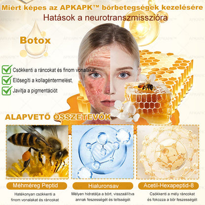 🏆𝖠𝖯𝖪𝖠𝖯𝖪® 🌿Méhméreges bőrregeneráló krém Segít kezelni különféle bőrproblémákat, mint például: ráncok, hegek, pigmentfoltok, striák, pattanások, pikkelysömör, ekcéma, bőrkárosodások, irritációk, gyulladások és egyéb bőrproblémák💦