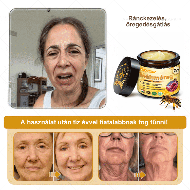 🏆𝖠𝖯𝖪𝖠𝖯𝖪® 🌿Méhméreges bőrregeneráló krém Segít kezelni különféle bőrproblémákat, mint például: ráncok, hegek, pigmentfoltok, striák, pattanások, pikkelysömör, ekcéma, bőrkárosodások, irritációk, gyulladások és egyéb bőrproblémák💦