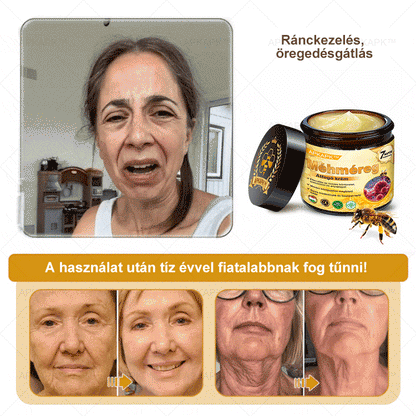 🏆𝖠𝖯𝖪𝖠𝖯𝖪® 🌿Méhméreges bőrregeneráló krém Segít kezelni különféle bőrproblémákat, mint például: ráncok, hegek, pigmentfoltok, striák, pattanások, pikkelysömör, ekcéma, bőrkárosodások, irritációk, gyulladások és egyéb bőrproblémák💦