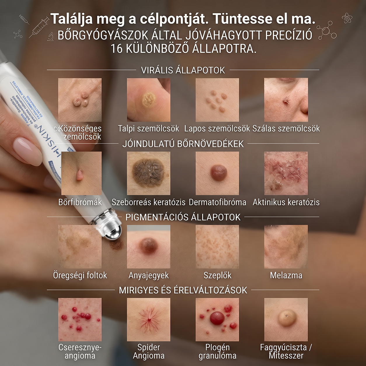 Hivatalos Márkabolt | 🖊️ Hiskin® 7 napos Szemölcseltávolító Roll-on Ápoló Folyadék (Fájdalommentes rollerball technológia, hegek nélkül) 🐬