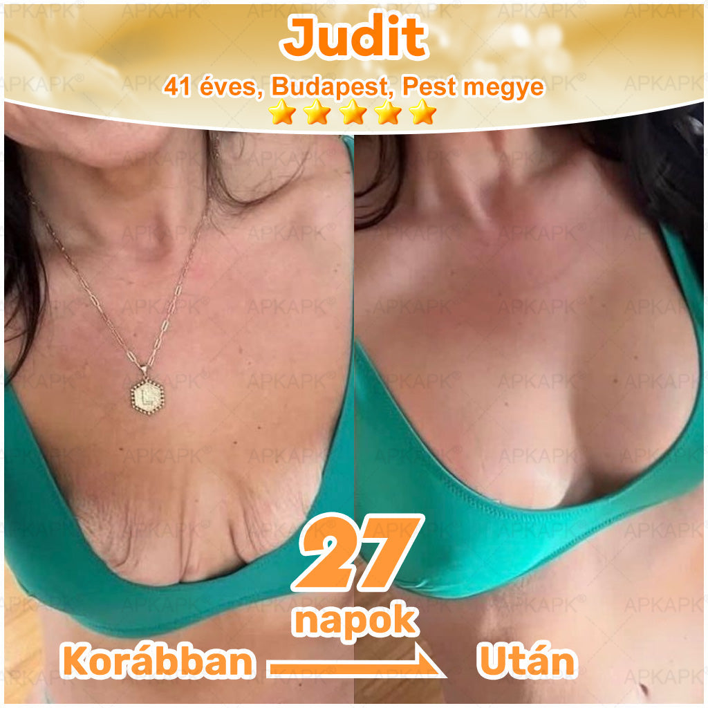 🏆𝖠𝖯𝖪𝖠𝖯𝖪® 🌿Méhméreges bőrregeneráló krém Segít kezelni különféle bőrproblémákat, mint például: ráncok, hegek, pigmentfoltok, striák, pattanások, pikkelysömör, ekcéma, bőrkárosodások, irritációk, gyulladások és egyéb bőrproblémák💦