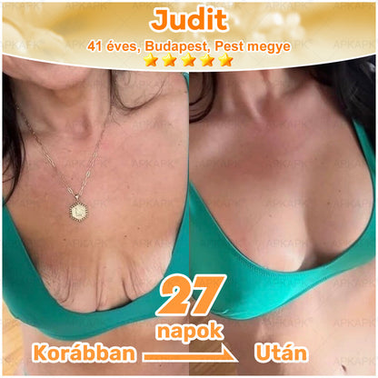 🏆𝖠𝖯𝖪𝖠𝖯𝖪® 🌿Méhméreges bőrregeneráló krém Segít kezelni különféle bőrproblémákat, mint például: ráncok, hegek, pigmentfoltok, striák, pattanások, pikkelysömör, ekcéma, bőrkárosodások, irritációk, gyulladások és egyéb bőrproblémák💦