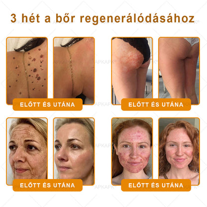 🏆𝖠𝖯𝖪𝖠𝖯𝖪® 🌿Méhméreges bőrregeneráló krém Segít kezelni különféle bőrproblémákat, mint például: ráncok, hegek, pigmentfoltok, striák, pattanások, pikkelysömör, ekcéma, bőrkárosodások, irritációk, gyulladások és egyéb bőrproblémák💦