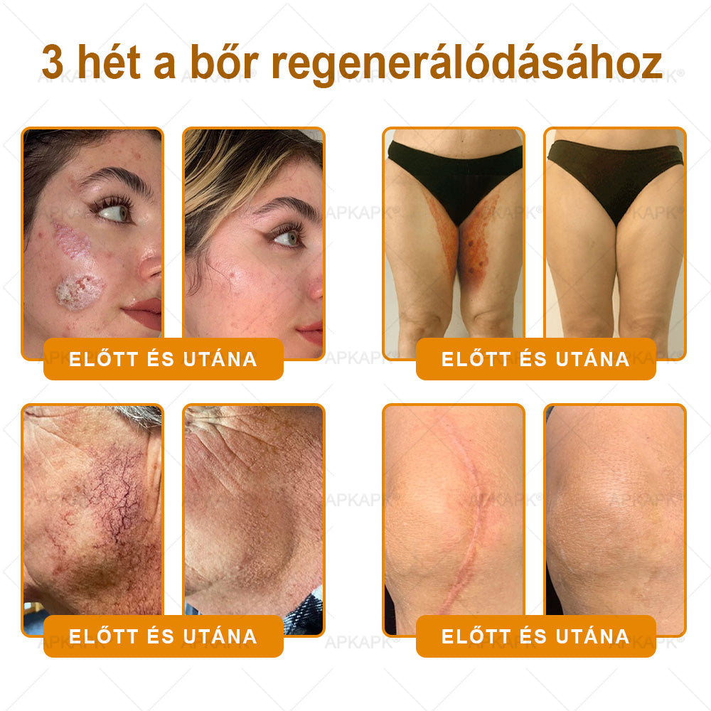 🏆𝖠𝖯𝖪𝖠𝖯𝖪® 🌿Méhméreges bőrregeneráló krém Segít kezelni különféle bőrproblémákat, mint például: ráncok, hegek, pigmentfoltok, striák, pattanások, pikkelysömör, ekcéma, bőrkárosodások, irritációk, gyulladások és egyéb bőrproblémák💦