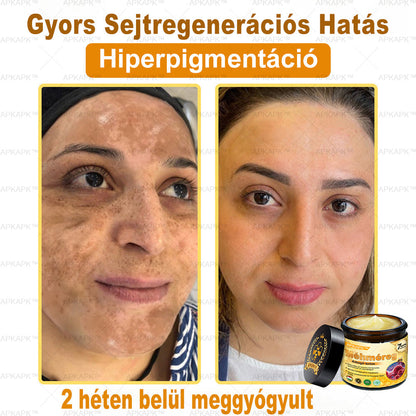 🏆𝖠𝖯𝖪𝖠𝖯𝖪® 🌿Méhméreges bőrregeneráló krém Segít kezelni különféle bőrproblémákat, mint például: ráncok, hegek, pigmentfoltok, striák, pattanások, pikkelysömör, ekcéma, bőrkárosodások, irritációk, gyulladások és egyéb bőrproblémák💦