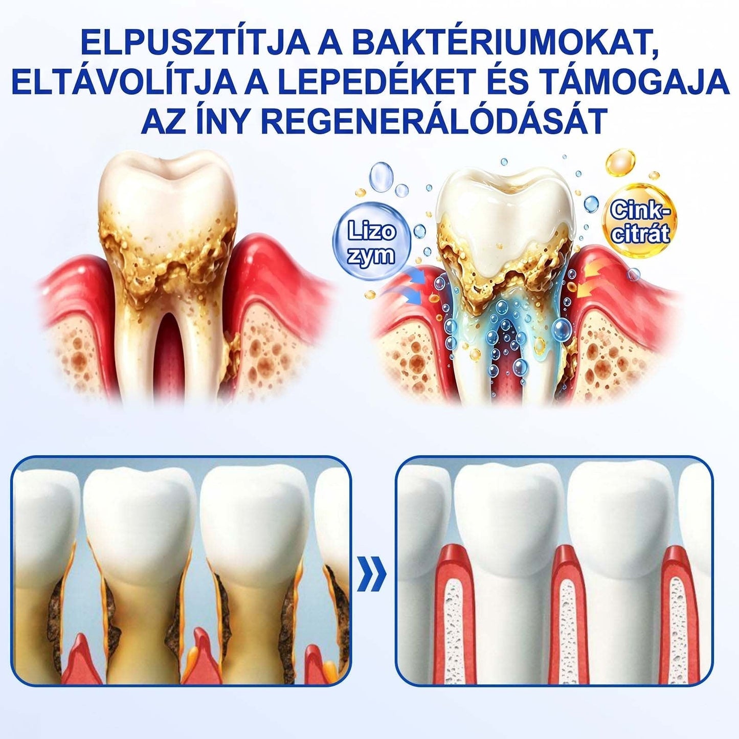PureShade® 💧 GumRevive Ínyregeneráló Gél – Az egészségesebb ínyért és magabiztosabb mosolyért 🦷