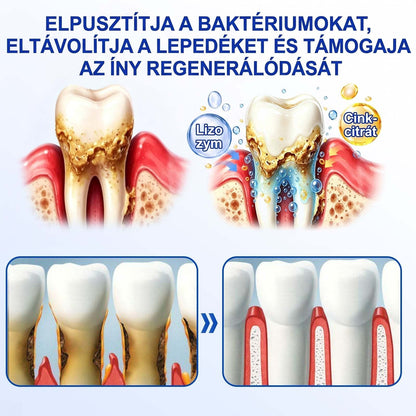 PureShade® 💧 GumRevive Ínyregeneráló Gél – Az egészségesebb ínyért és magabiztosabb mosolyért 🦷