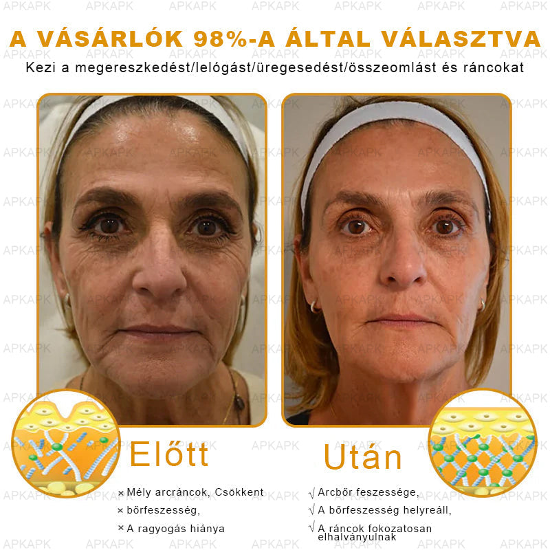 🏆𝖠𝖯𝖪𝖠𝖯𝖪® 🌿Méhméreges bőrregeneráló krém Segít kezelni különféle bőrproblémákat, mint például: ráncok, hegek, pigmentfoltok, striák, pattanások, pikkelysömör, ekcéma, bőrkárosodások, irritációk, gyulladások és egyéb bőrproblémák💦