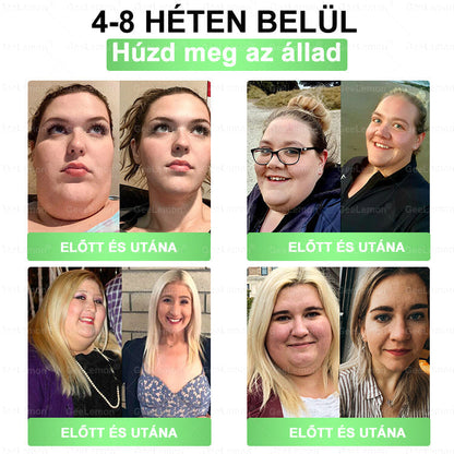 🥇 GeeLemon® 8 az 1-ben karcsúsító nano mikrotűs tapasz 🇭🇺 (Napi egyszeri használat, látható változások már 7 nap alatt) ✅Elhízás,megereszkedett bőr,cukorbetegség,alvási apnoe,ízületi problémák és még sok más esetén