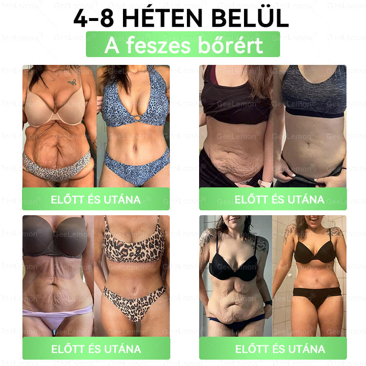 🥇 GeeLemon® 8 az 1-ben karcsúsító nano mikrotűs tapasz 🇭🇺 (Napi egyszeri használat, látható változások már 7 nap alatt) ✅Elhízás,megereszkedett bőr,cukorbetegség,alvási apnoe,ízületi problémák és még sok más esetén